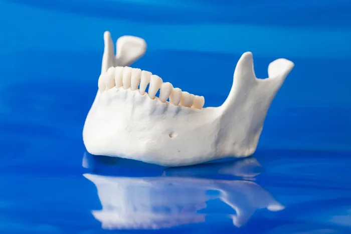 Jaw bone showing bone grafting area